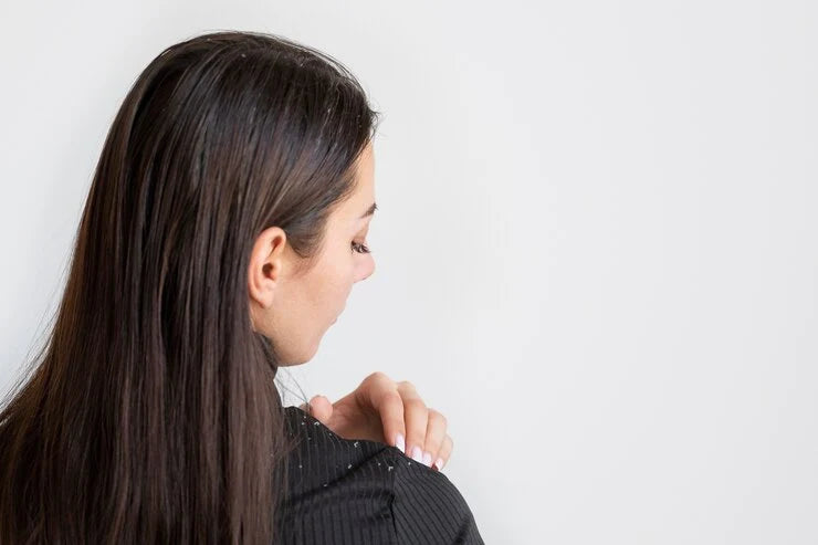 Why Is Anti-Dandruff Shampoo Good for Any Scalp