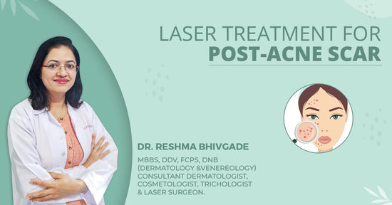 Laser Treatment for Post-Acne Scar - Kshipra Health Solutions