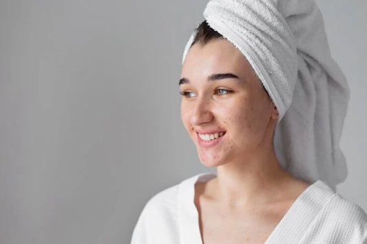 How to Get Rid of Acne Marks and Blemishes